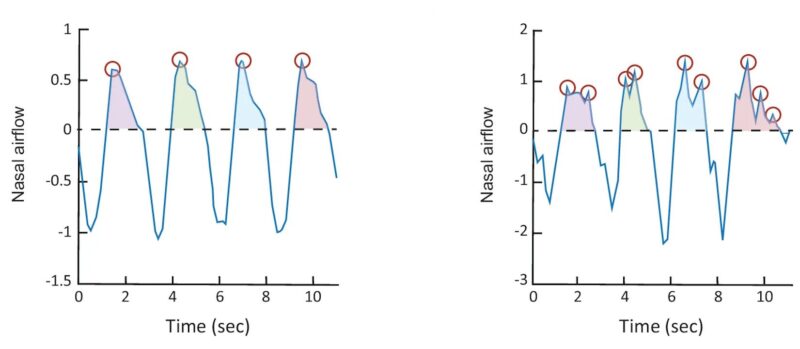 Дихання людини зі вродженою відсутністю нюху (зліва) та здорового добровольця (справа). Червоні кола позначають дихальні піки.&amp;nbsp;Gorodisky et al. /&amp;nbsp;Nature Communications, 2024