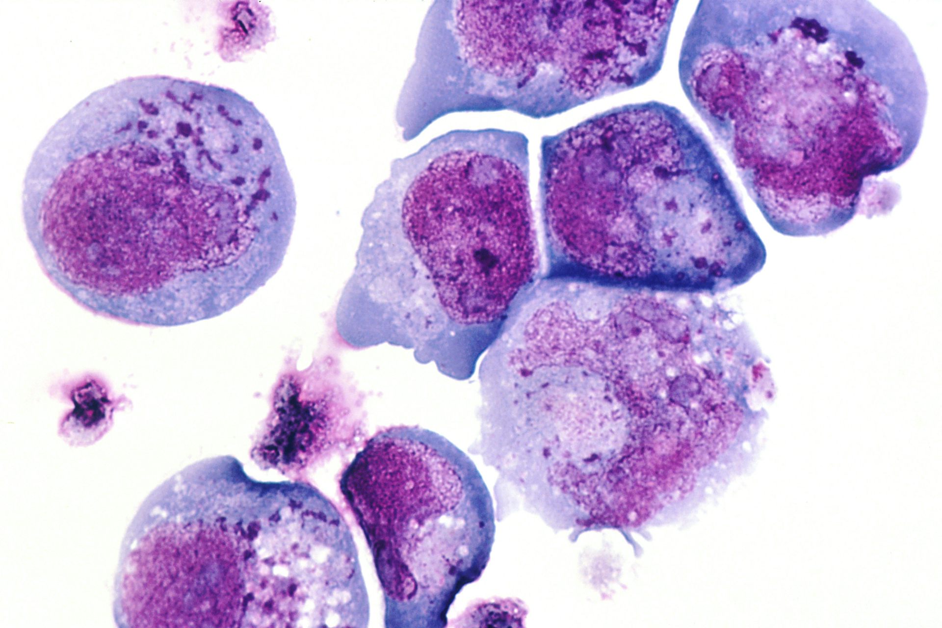 Microscopy image of round lavender blobs with round magenta blobs within them