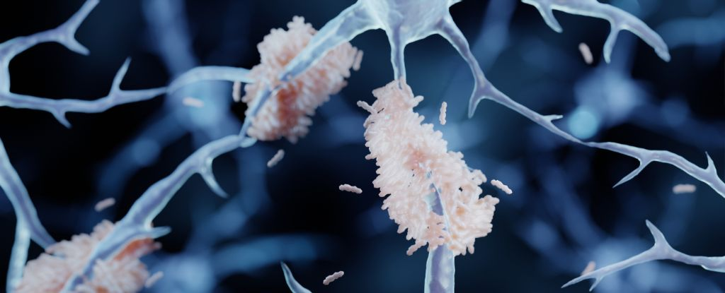 Вісцеральний жир у середньому віці пов’язаний із ризиком деменції