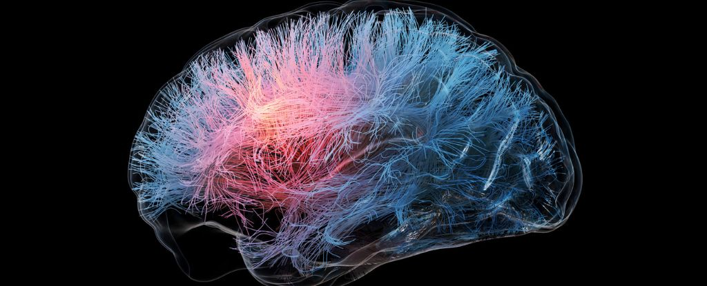 Жіночий мозок може гірше реагувати на нові ліки проти Альцгеймера – дослідження