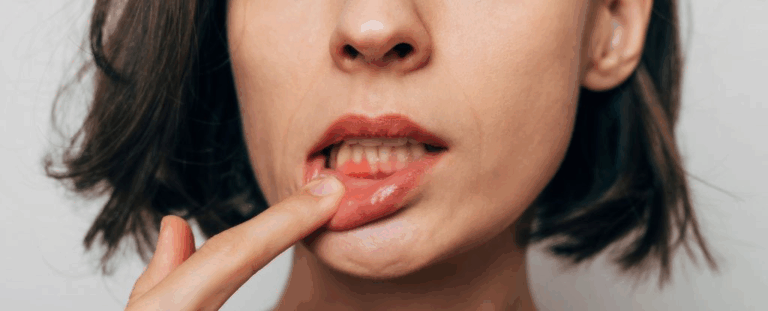 Вчені виявили зв'язок між здоров'ям рота і серця