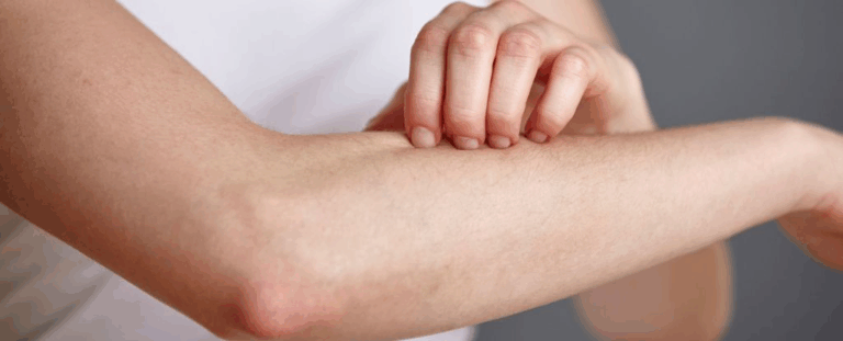 Знайдено природного ворога смертельного стафілокока: він живе прямо на вашій шкірі