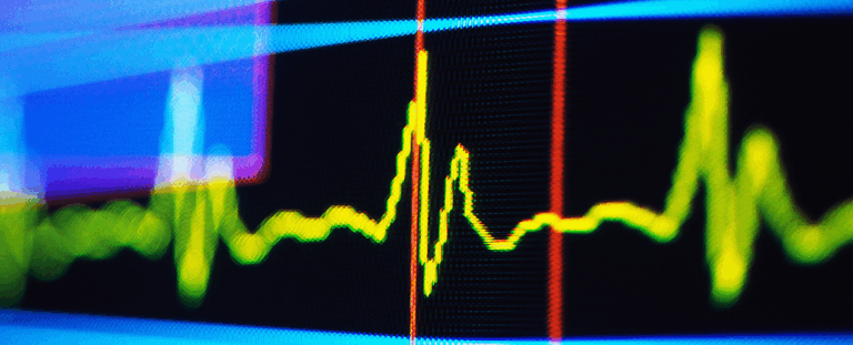 Серцевий ритм уві сні може вказувати на деменцію