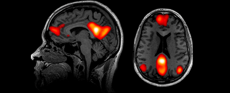 Чому нудьга потрібна нашому мозку: несподівані переваги для психічного здоров’я