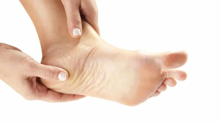 Лікування п’яткової шпори в домашніх умовах