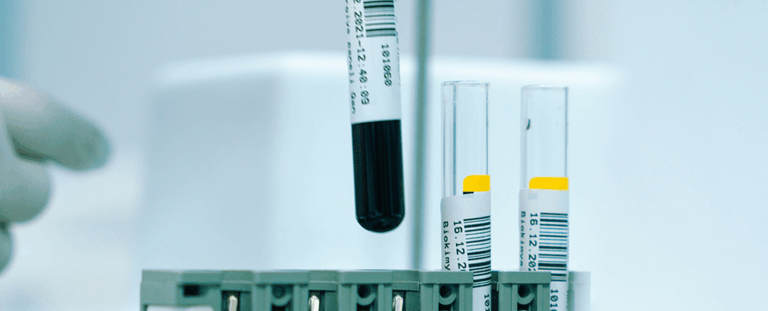 Революція в онкології: вчені навчилися виявляти рак у крові за три роки до діагнозу
