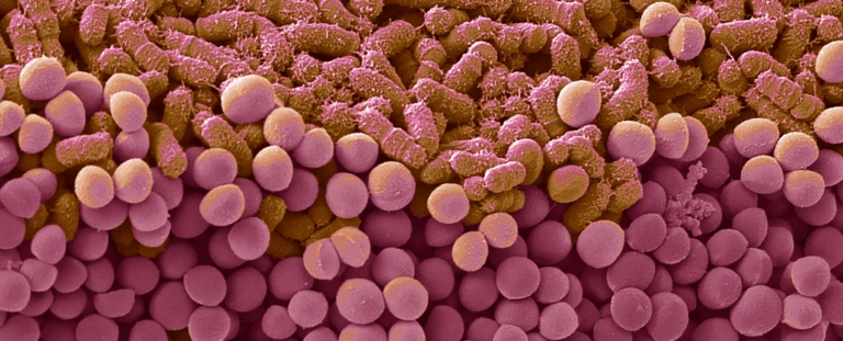 Ефект "йо-йо-дієт": вчені пов’язали зриви у харчуванні зі змінами в кишковій мікрофлорі