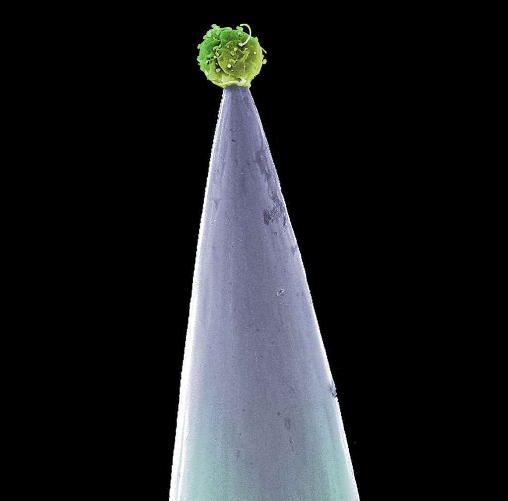 Британський науковий фотограф виграв престижну премію за знімок клітини печінки з холестерином