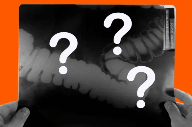 Штучний інтелект у медицині: чи шкодить AI навичкам лікарів