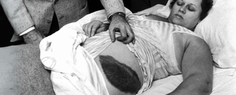 Єдина людина в історії, яку вдарив метеорит: неймовірна історія Анн Ходжес