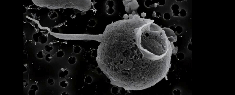 Вчені виявили вірус із найдовшим «хвостом» у світі