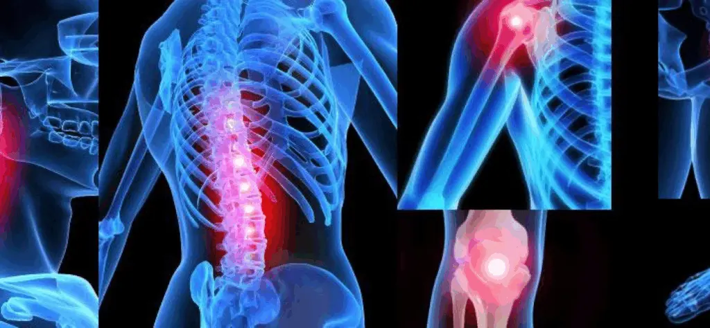 Фасціальні техніки в кінезитерапії