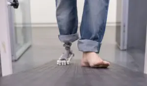 В Італії створили протез, який рухається як справжня нога