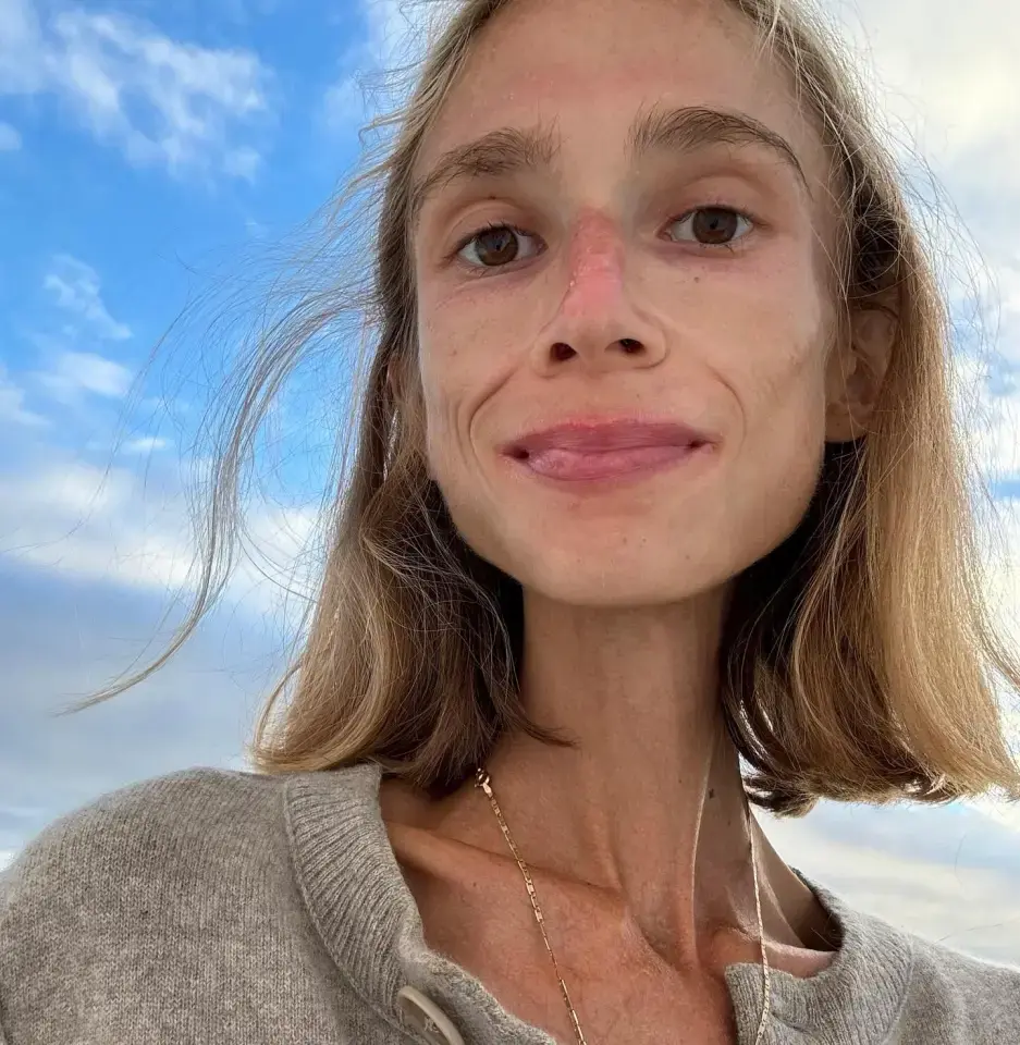 Померла на Балі після “фруктової дієти”: історія, яка шокувала світ