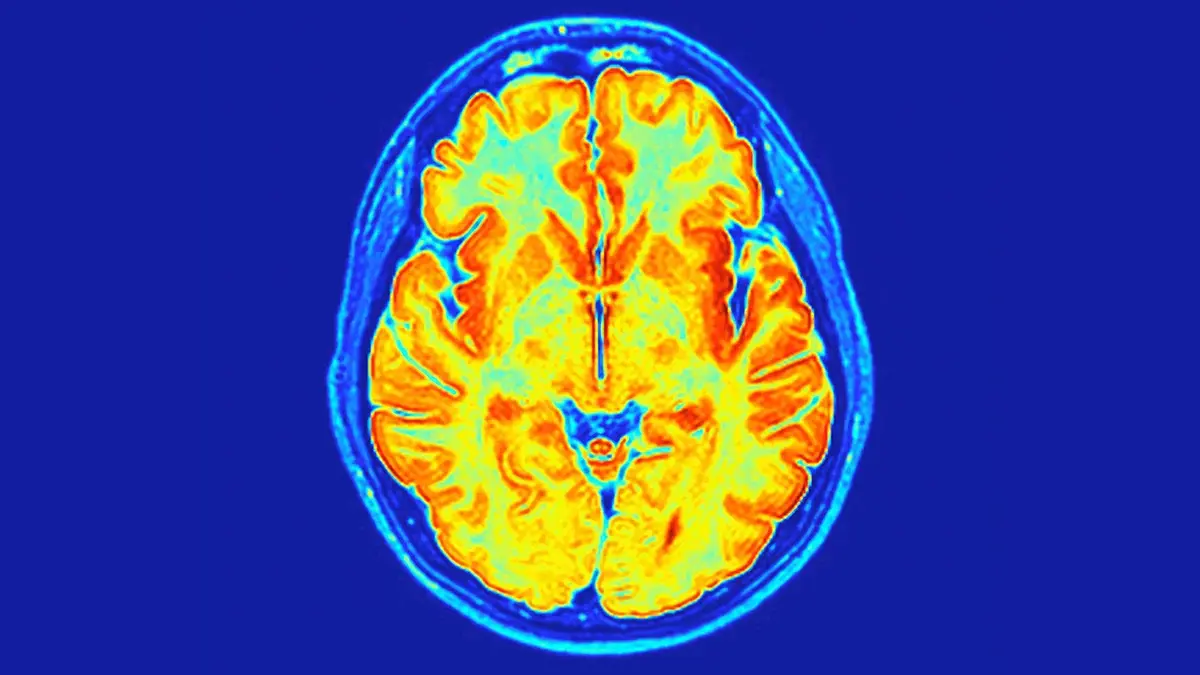 Генетична загадка розкрита: новий синдром пояснює затримки розвитку