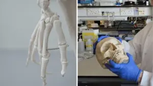 Вчені перетворили вовну на матеріал для відновлення кісток